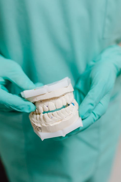 Tipos de prótese dentária — diferentes modelos de próteses usadas em reabilitação oral