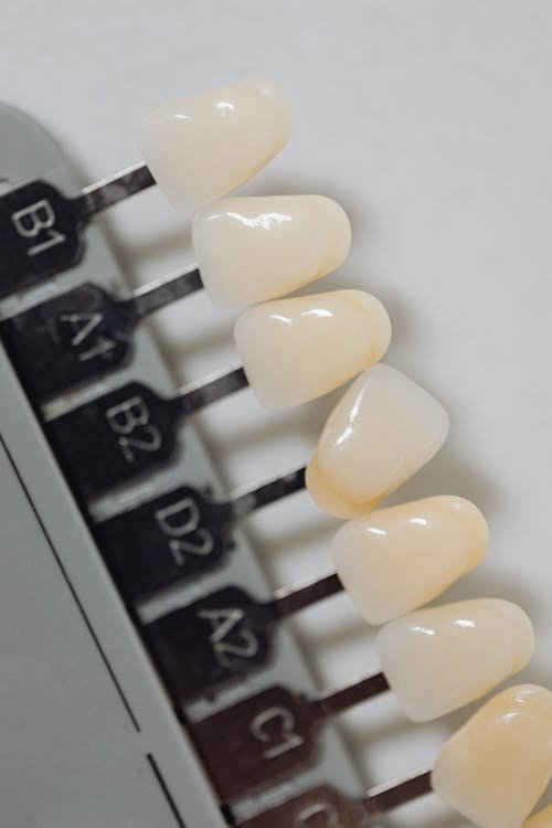 Guia de tons para escolha entre resina ou porcelana em próteses dentárias — IM Odontologia Integrada Curitiba