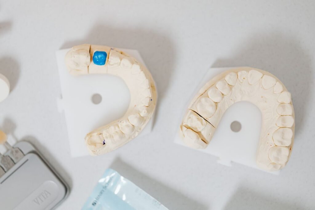 Implante dentário preço popular — clínica especializada em implantes e próteses em Curitiba