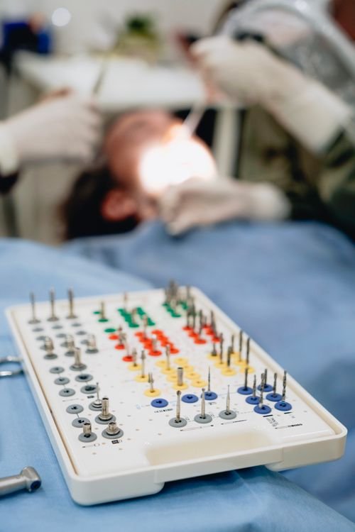 Implante dentário valor 2 dentes — clínica especializada em implantes e próteses em Curitiba