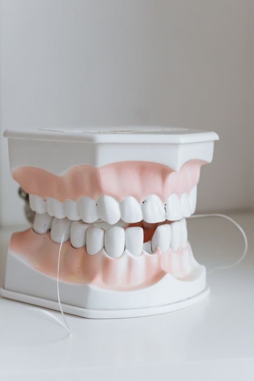 Para que serve o dente siso — clínica especializada em implantes e próteses em Curitiba