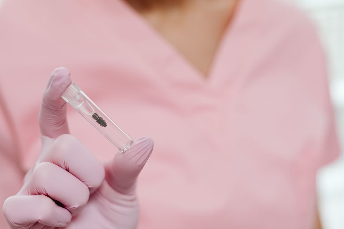 Quanto tempo depois do implante pode colocar o dente provisório — clínica especializada em implantes e próteses em Curitiba