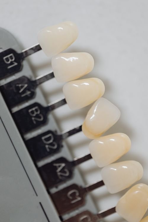 Siso inchado — clínica especializada em implantes e próteses em Curitiba